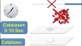 Catalase Coagulase and Oxidase Tests [upl. by Allevon458]