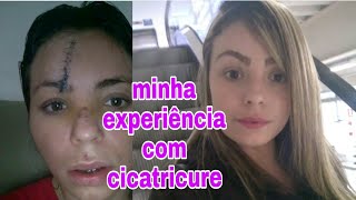 CICATRICURE FUNCIONA Minha experiência [upl. by Midian379]