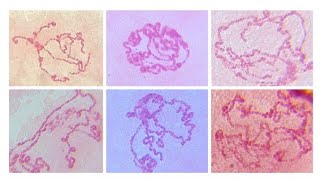 Images of polytene chromosome of Drosophila sp X150 X400 amp X1000 [upl. by Cartan]