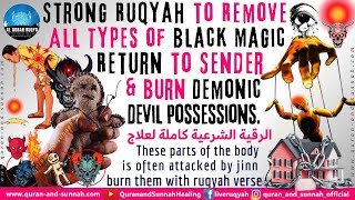 Ruqiya Al Sharciya to Remove All Types of Magic amp Return to Sender amp Burn Demonic Devil Possessions [upl. by Arlina89]