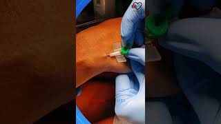 IV Cannula  IV line inserting aiims aiimsnorcet doctor gnm medico nursing hospital health [upl. by Wilkens]