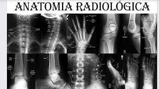 INTRODUÇÃO À ANATOMIA RADIOLÓGICA [upl. by Giustina979]