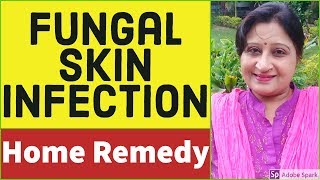 Skin Fungal Infection Treatment  Skin Infection  How to cure Skin Fungus Naturally [upl. by Lyda]