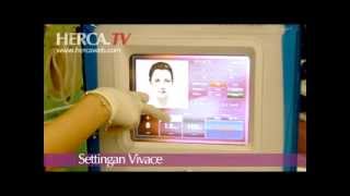 Vivace RF  stretch mark treatment [upl. by Urbana]