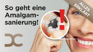 Amalgamsanierung Sicher Amalgam entfernen vor dem Zahnverlust  Risiken von Amalgamfüllungen [upl. by Dinesh]