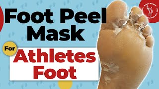 Foot Peel Mask Treatment For Athletes Foot [upl. by Arimahs810]