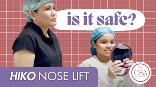 Hiko Nose Lift in 10 minutes  Dr Contessa Salvador [upl. by Adnwahs]