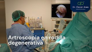 Artroscopia en rodilla degenerativa  Dr Oscar Ares [upl. by Arimaj]