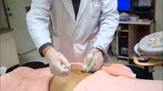 Ultrasound Guided Sacroiliac Joint Injection [upl. by Kylie]