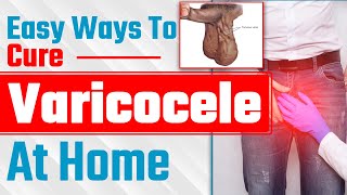 Easy Ways To Cure a Varicocele At Home  अपने वैरीकोसेल को Reverse कैसे करे  Dr Health [upl. by Ahsiek]