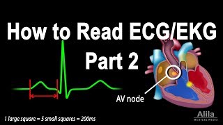 How to Read ECGEKG Part 2 Animation [upl. by Asuncion]