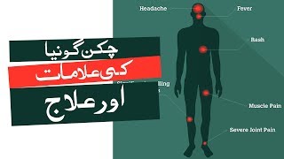 Chikungunya Virus Easy Home Treatment In Urdu  chikungunya ka behtareen elaj [upl. by Ahsirtak]