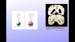 Unit7G DNA Mutation and Repair Triplet Repeat Expansion [upl. by Church]