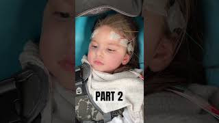 INFANTILE SPASMS INVESTIGATION PART 2  Hypsarrythmia epilepsy [upl. by Macknair]