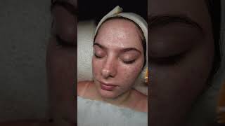 What Self Care Looks Like 🥰 estheticianlife skincareasmr skincaretips [upl. by Imoen]