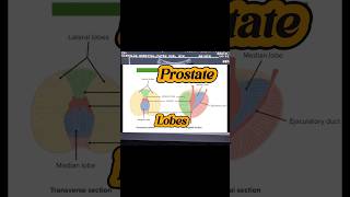 Prostate Ultrasound  Enlarged Prostate  BPH  Median Lobe Prostate  Prostatomegaly on Usg [upl. by Corena]