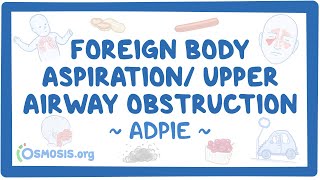 Foreign body aspiration  upper airway obstruction Nursing Process [upl. by Yelyac]