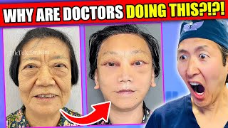 EXTREME Asian Plastic Surgery TikToks WHY [upl. by Llerad903]