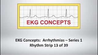 EKG Concepts Arrhythmias Course  Strip 13 of 39 [upl. by Eoj700]