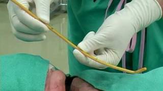 BougieAided Cricothyrotomy by Darren Braude [upl. by Amlet]