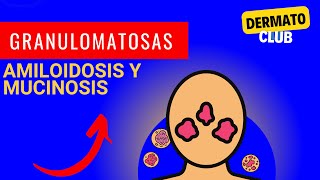 Enfermedades granulomatosas sarcoidosis amiloidosis y mucinosis [upl. by Suiddaht]