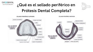 ¿Qué es el SELLADO PERIFÉRICO en PRÓTESIS DENTAL COMPLETA  LA GUÍA PASO A PASO [upl. by Nirol]