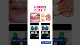 HERPES CURE herpes herpesvirus droffala hsv2 hsv1 hsv genitalherpes holistichealth herbs [upl. by Alegnasor]