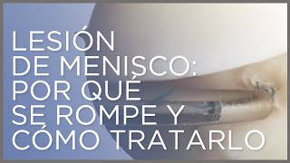 Lesión de menisco por qué se rompe y cómo tratarlo [upl. by Valdes]