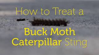 🐛 How to Treat a Buck Moth Caterpillar Sting [upl. by Stauffer]