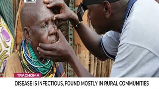 Trachoma is the leading cause of blindness  Experts [upl. by Hcir809]