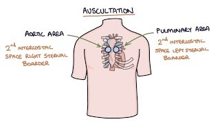 Heart Murmurs and Heart Sounds Visual Explanation for Students [upl. by Legnaleugim870]