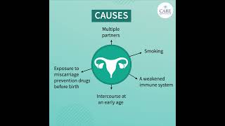 Things You Need to Know About Cervical Cancer  CARE Hospitals [upl. by Llorrad925]