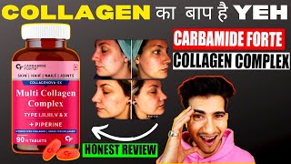 carbamide forte collagen review  Best Collagen Supplement in India [upl. by Farra22]