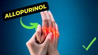 Allopurinol An Ultimate Guide To Its Uses Benefits and Side Effects [upl. by Marita]