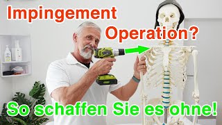 Impingement OP der Schulter ➡️ So schaffen Sie es ohne [upl. by Amero]