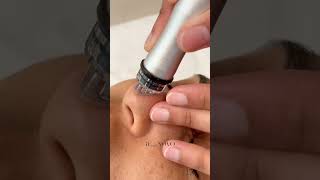 Want antiaging pore blackhead and wrinkle removal without downtime Try Cell Care Treatment 🤩 [upl. by Ongineb]