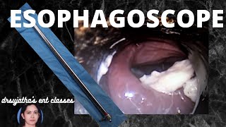 104Rigid esophagoscopy  Indication Contraindication Procedure steps oesophagus scopy [upl. by Herring]