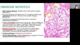 GLOMERULONEFRITIS ll [upl. by Eillo335]