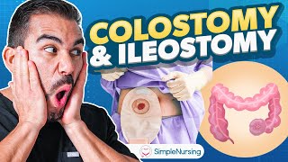 Colostomy and Ileostomy Nursing  Indications Complications Care EASY [upl. by Hennebery102]