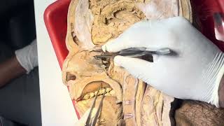 Lateral wall of nose dissection and sagittal section of head and neck [upl. by Annor]