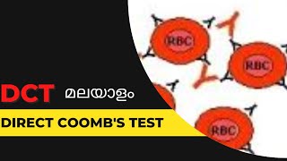 DCTDirect Coombs test മലയാളം [upl. by Tore64]