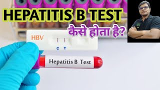 HBsAg test  Hepatitis B virus  Hepatitis B surface antigen test [upl. by Reinal]