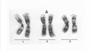diferencias entre cromosomas [upl. by Naga331]