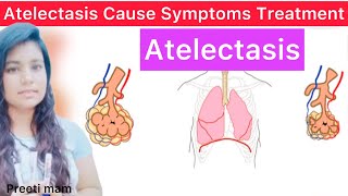 Atelectasis Cause Symptom Diagnose Treatment Hindi  What is Atelectasis  Atelectasis Cause Symptom [upl. by Ledniahs629]