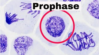 Cell division meiosis 1 prophase Ileptotene Zygotenepachytene diplotene and diakinesis [upl. by Anema]