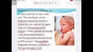 Measles quotpediatric quot [upl. by Ecyor]