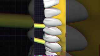 💻✍🏻 Modelação de gengiva exocad dentista dentist cadcam dental [upl. by Yurik]