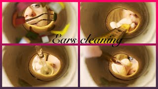 ASMR Ears cleaning [upl. by Gerdy658]