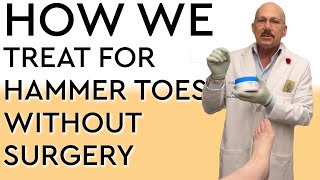 How We Treat Hammer Toes NonSurgically [upl. by Reena]