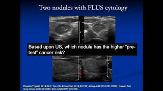 Thyroid Fine Needle Aspiration FNA and Cytology [upl. by Ettenawtna134]